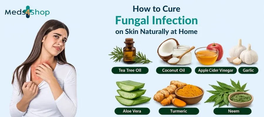 How to Cure Fungal Infection on Skin Naturally at Home